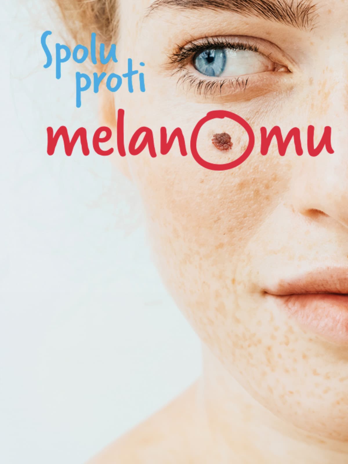 Prevence melanomu a kontrola znamének